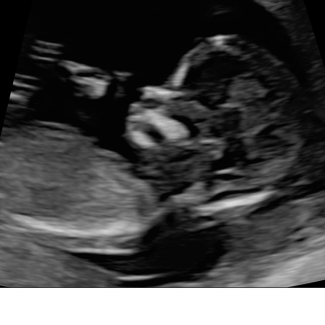 Photo shared by Rylee for their Babylist baby registry.