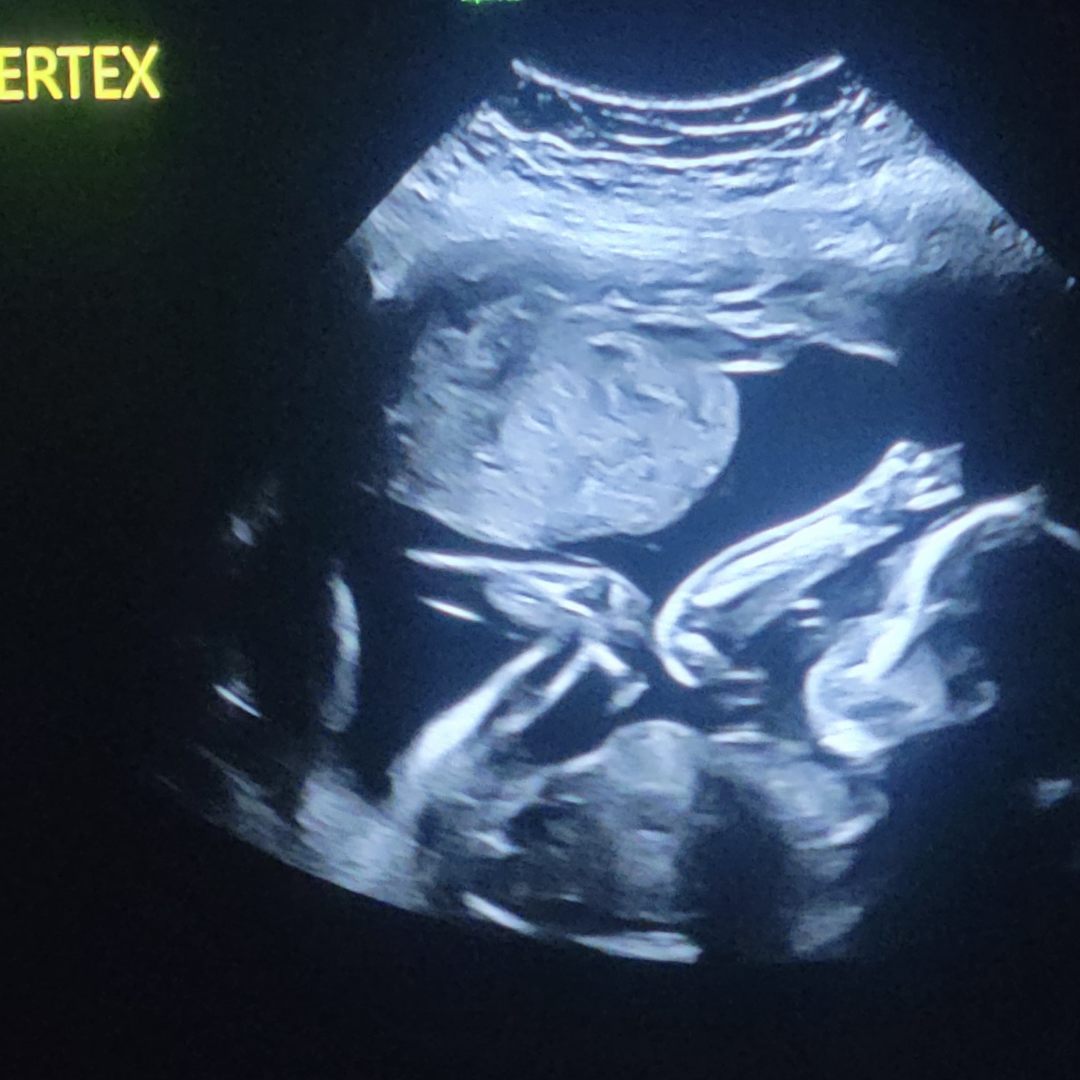 Photo shared by Diana for their Babylist baby registry.