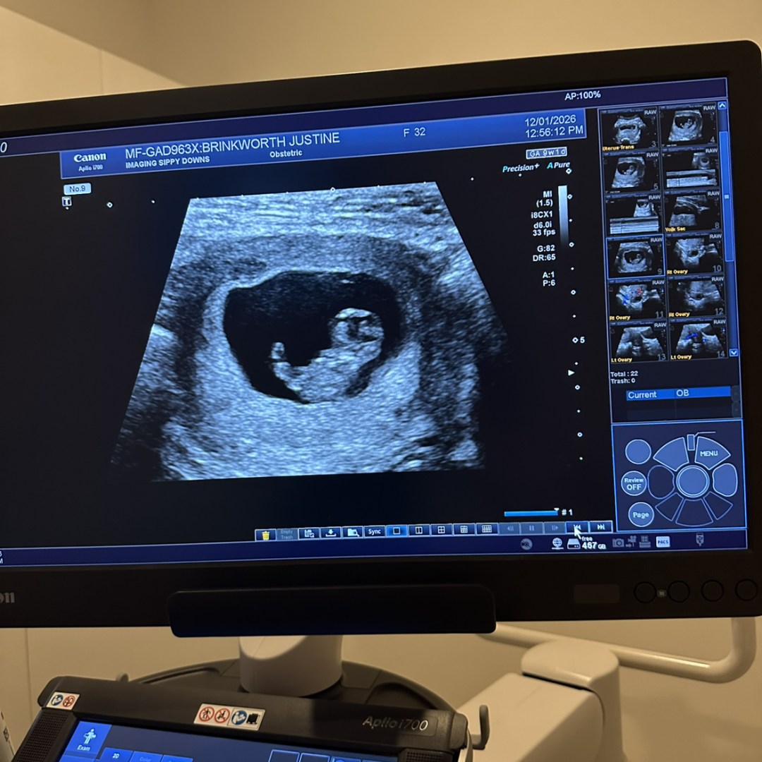 Photo shared by Justine for their Babylist baby registry.