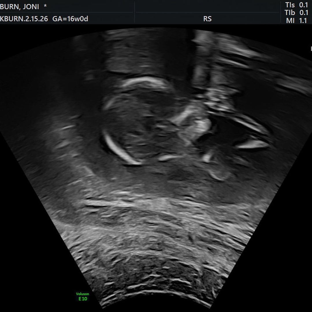 Photo shared by Joni for their Babylist baby registry.