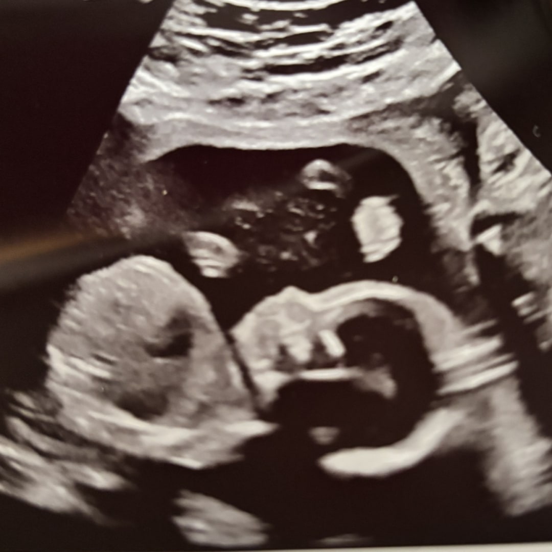 Photo shared by Kaitlin for their Babylist baby registry.
