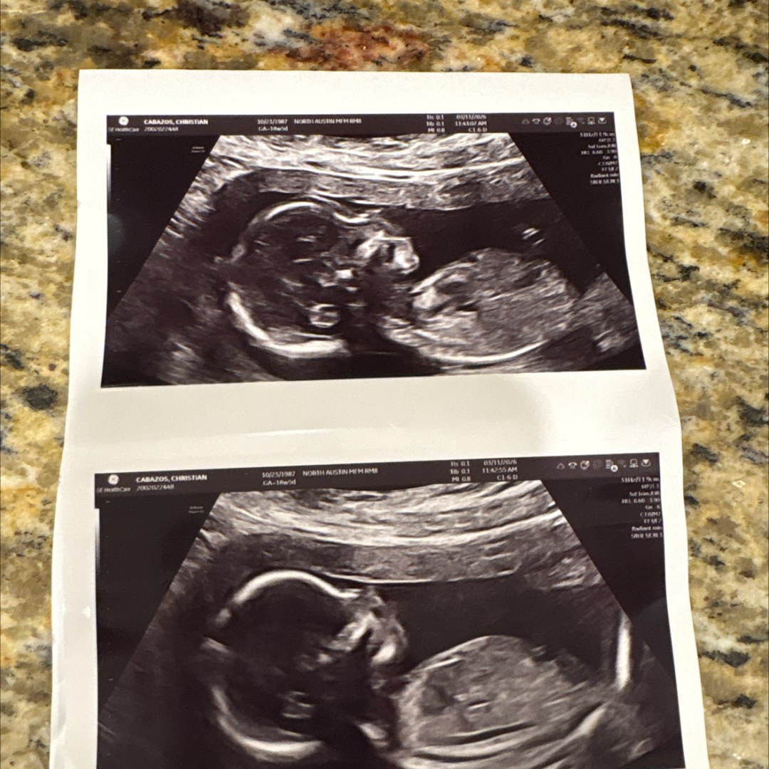 Photo shared by Christian for their Babylist baby registry.