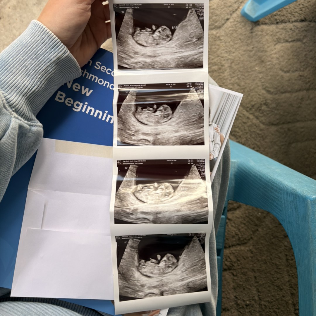 Photo shared by Aurie for their Babylist baby registry.
