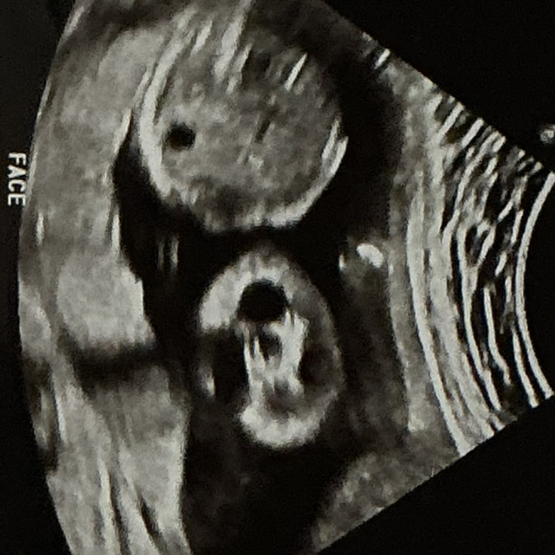 Photo shared by IvyRose for their Babylist baby registry.
