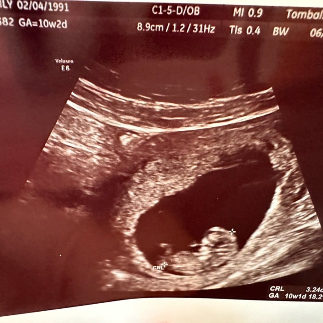 Photo shared by Emily for their Babylist baby registry.