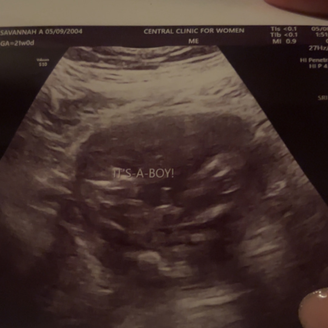 Photo shared by Savannah for their Babylist baby registry.