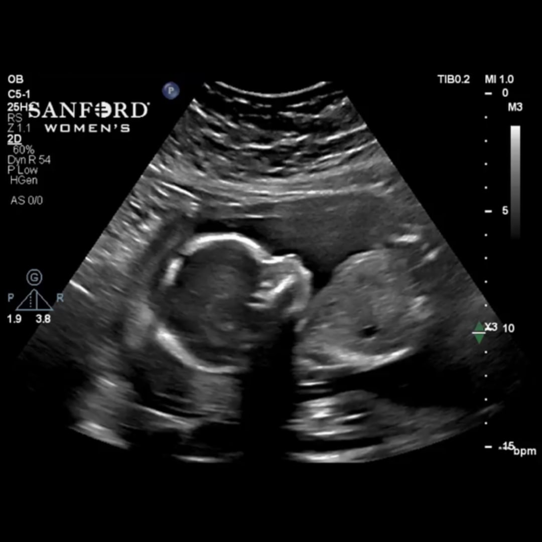 Photo shared by Cora for their Babylist baby registry.