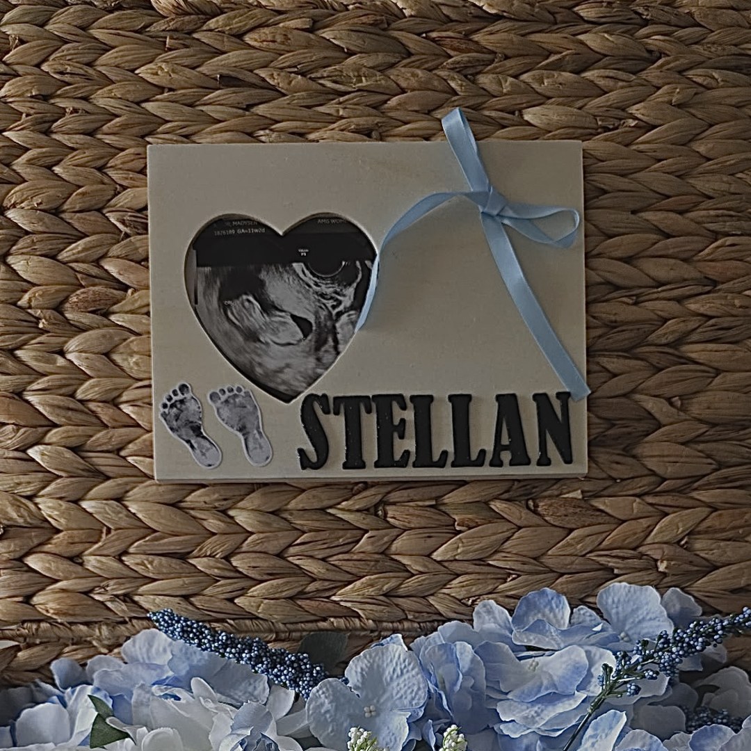 Photo shared by Madysen for their Babylist baby registry.