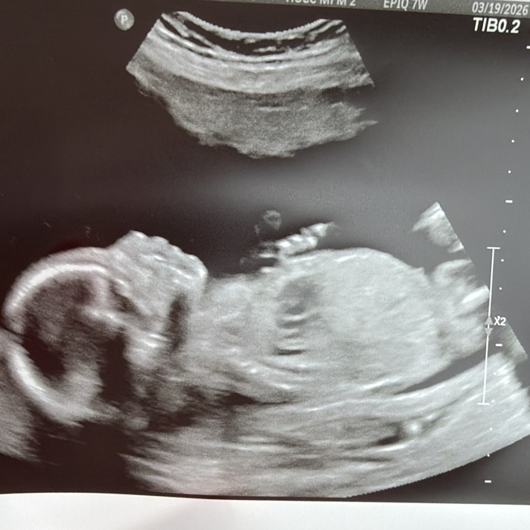 Photo shared by Gaby for their Babylist baby registry.