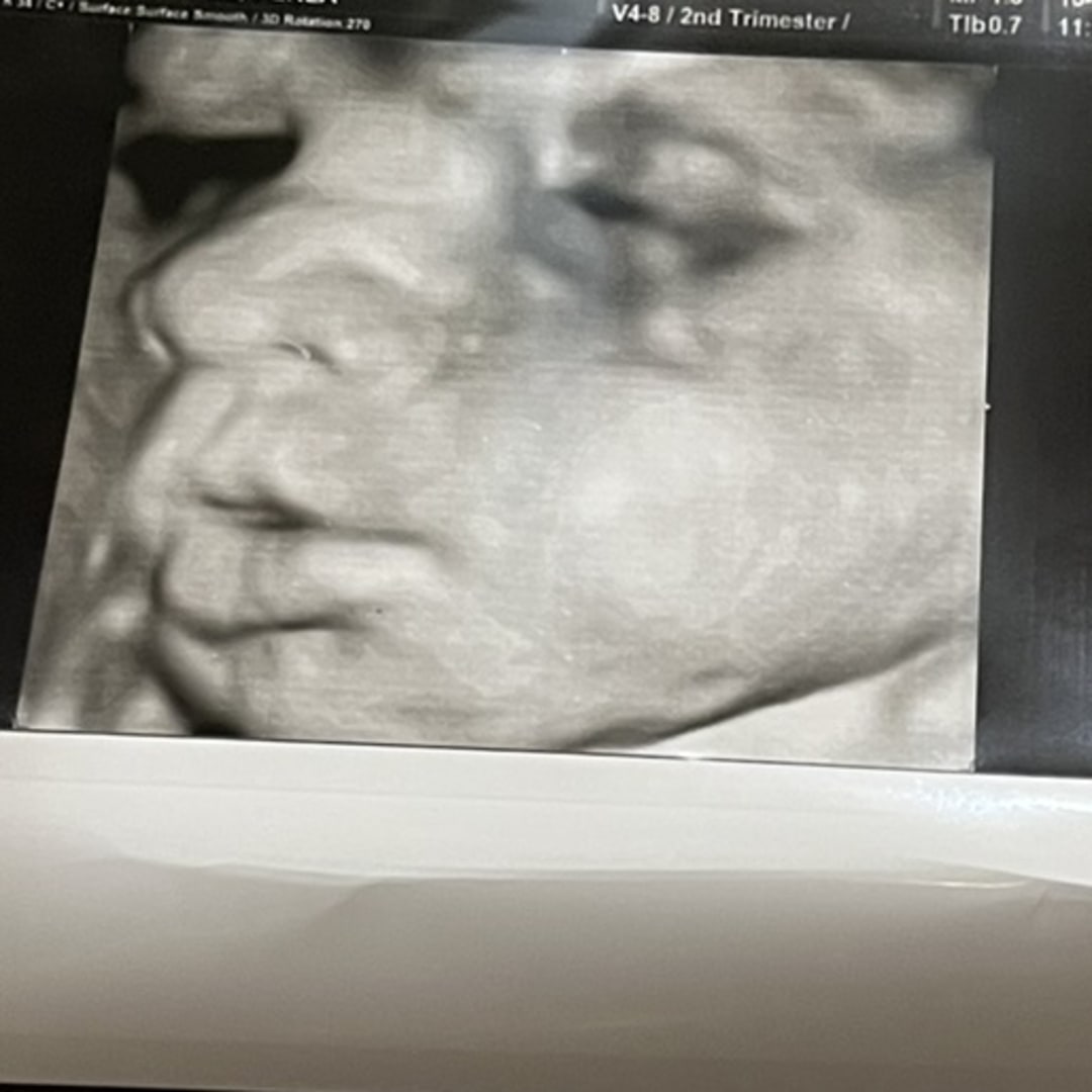 Photo shared by Perla for their Babylist baby registry.