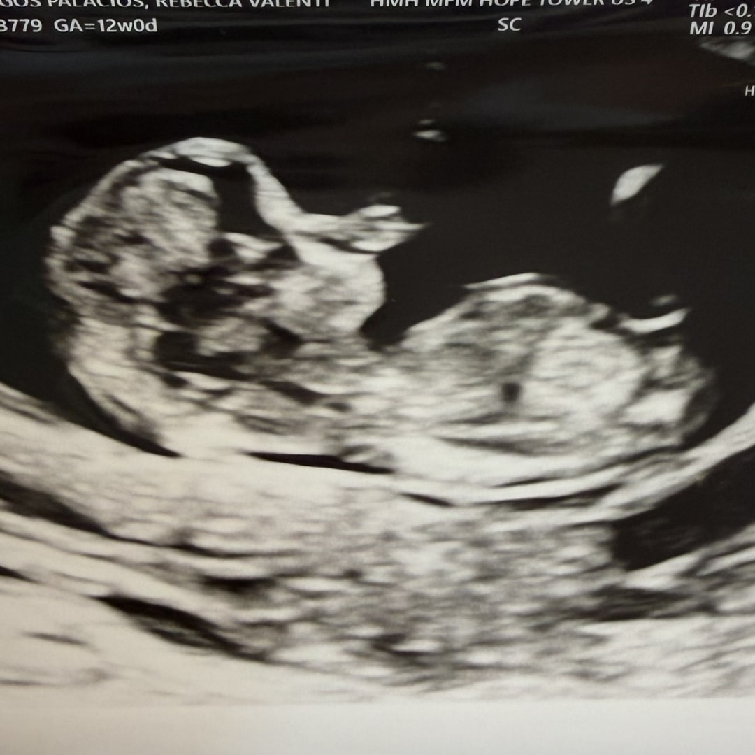Photo shared by Rebecca for their Babylist baby registry.