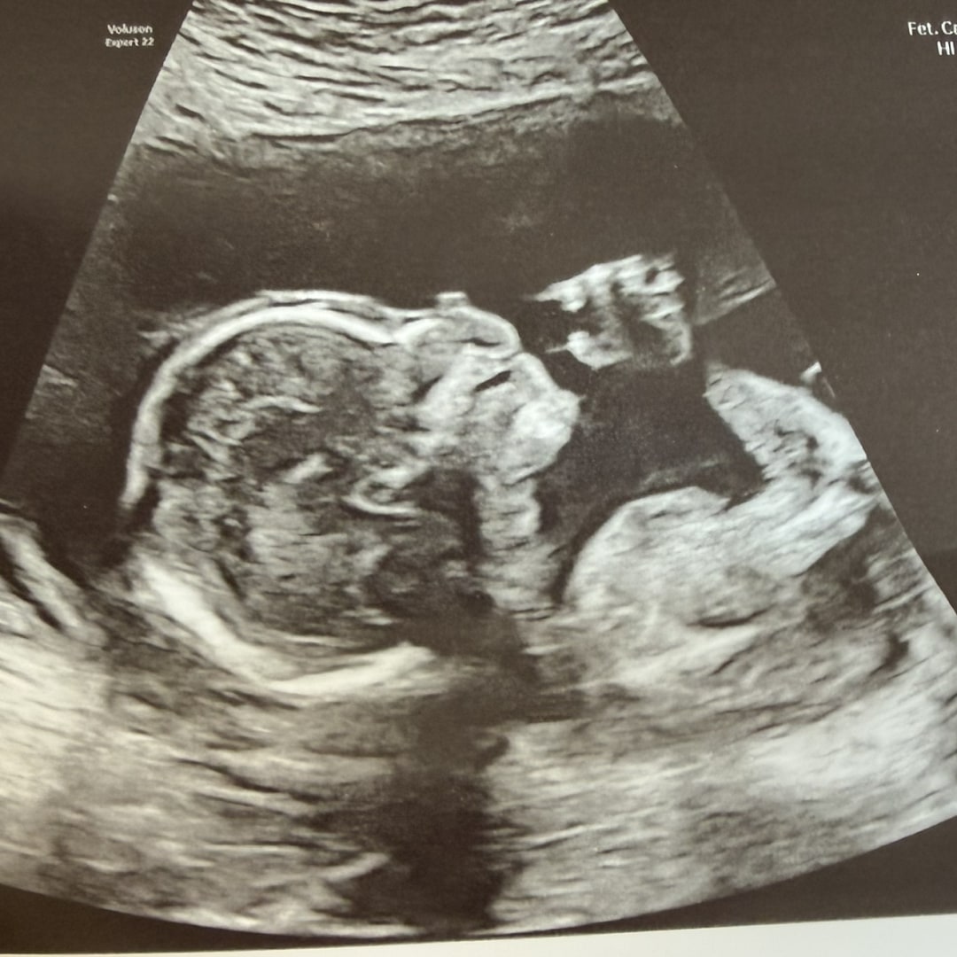 Photo shared by Kathryn for their Babylist baby registry.