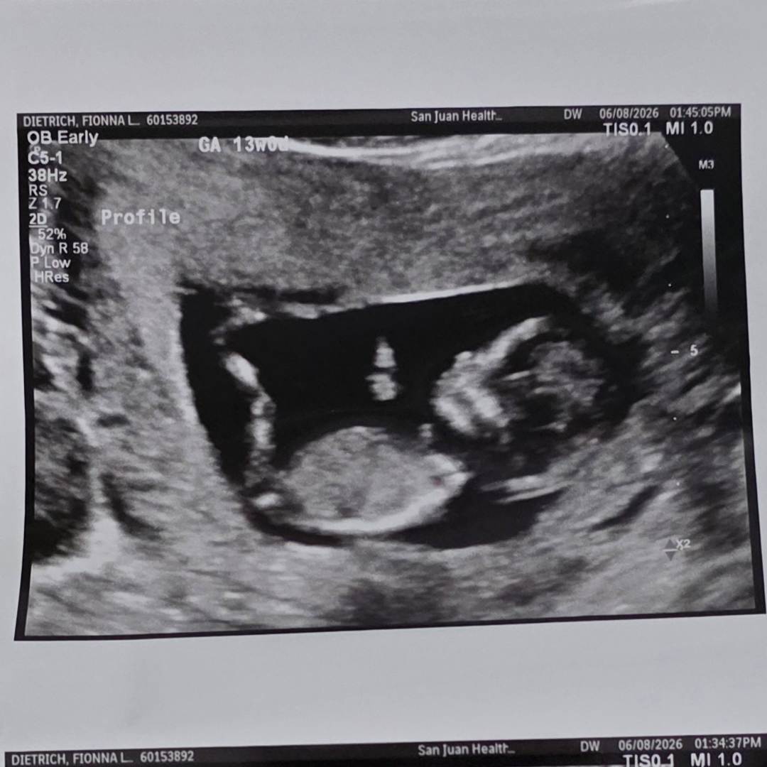 Photo shared by Fionna for their Babylist baby registry.