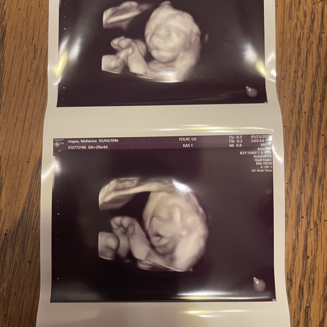 Photo shared by McKenna for their Babylist baby registry.