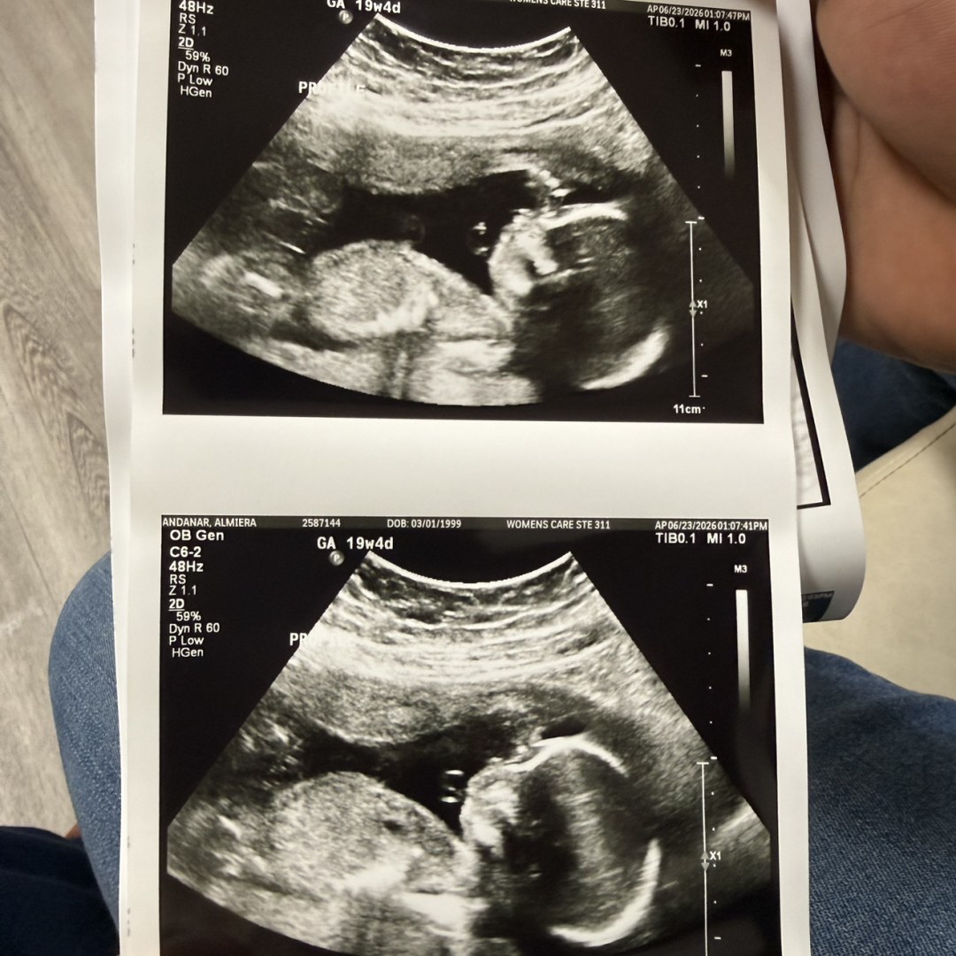 Photo shared by Almiera for their Babylist baby registry.