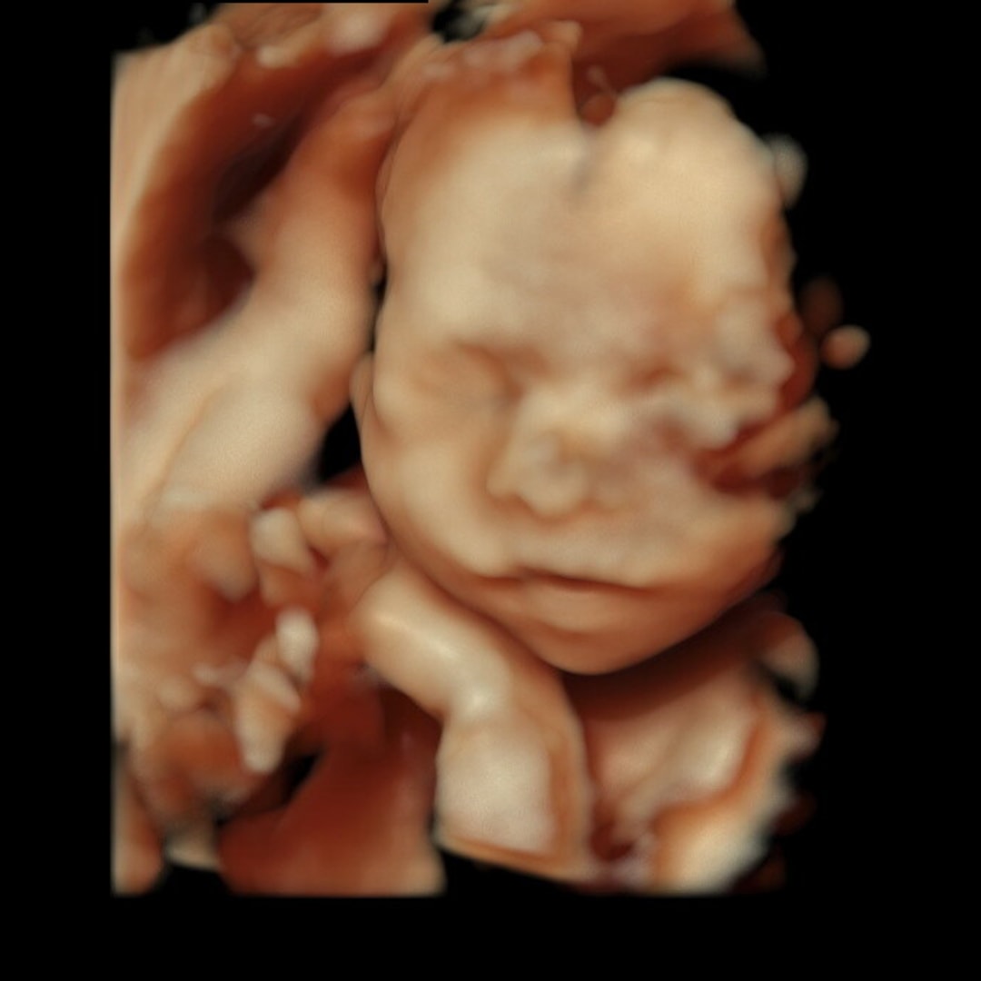 Photo shared by Kayla for their Babylist baby registry.