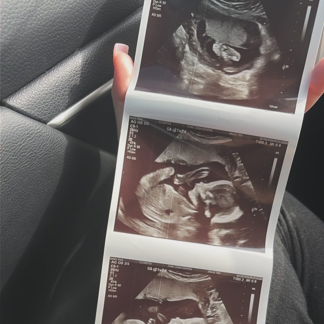 Photo shared by Kyra for their Babylist baby registry.