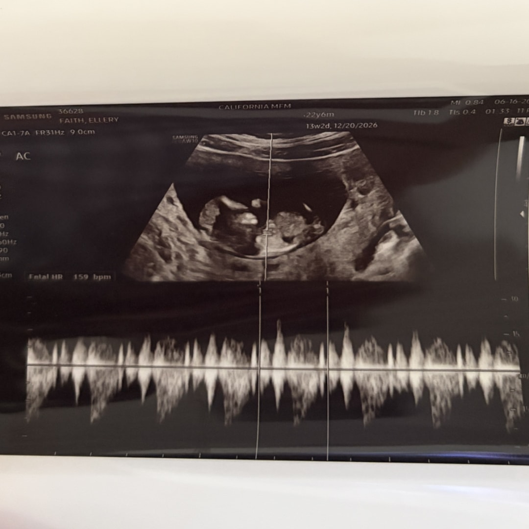 Photo shared by Ellery for their Babylist baby registry.