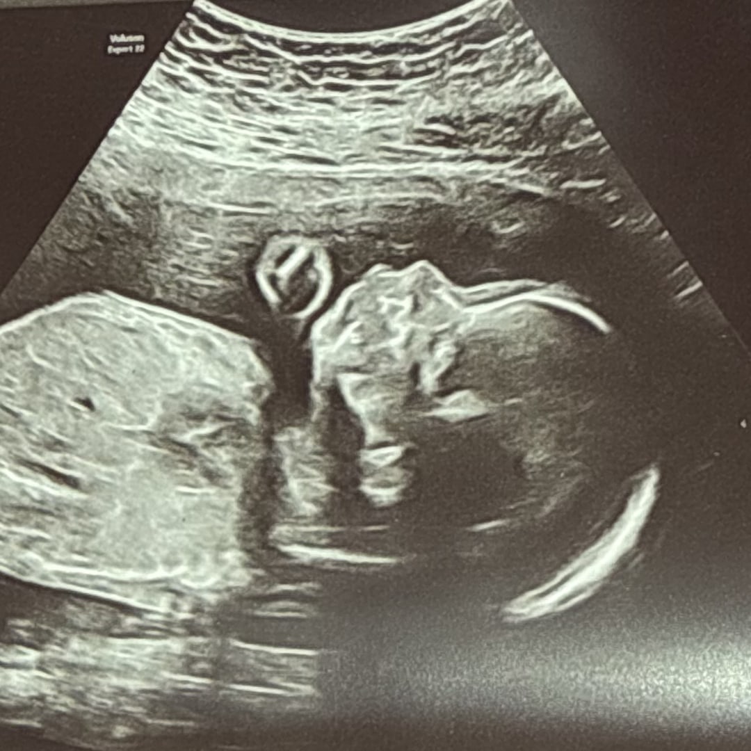 Photo shared by Marley for their Babylist baby registry.