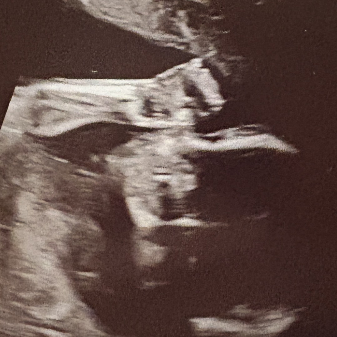 Photo shared by Caroline for their Babylist baby registry.