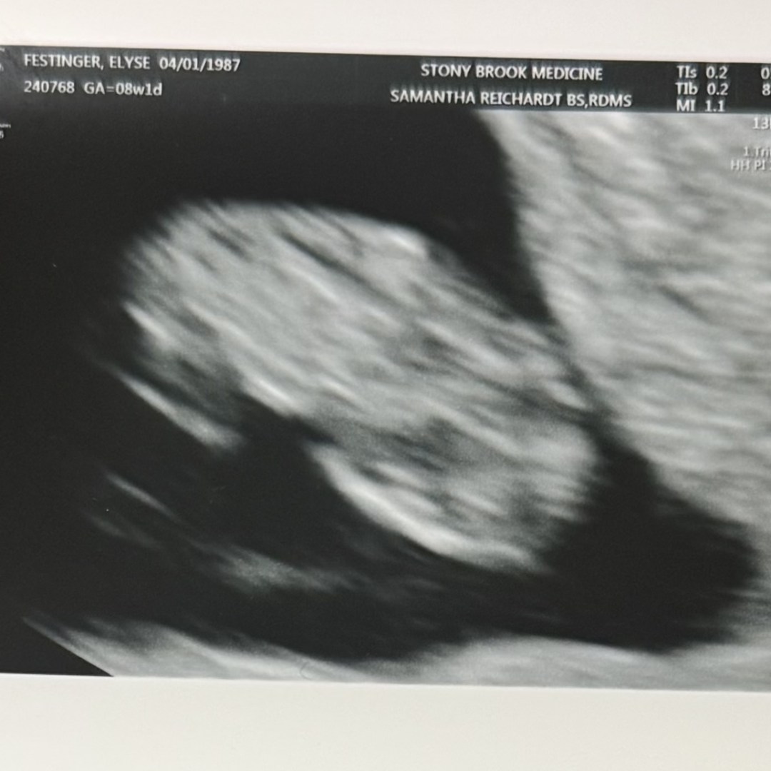 Photo shared by Elyse for their Babylist baby registry.