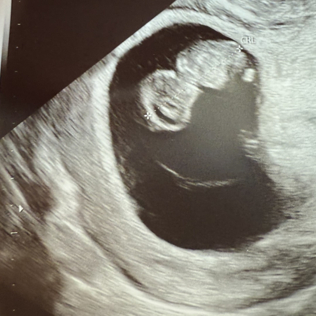 Photo shared by Anareli for their Babylist baby registry.