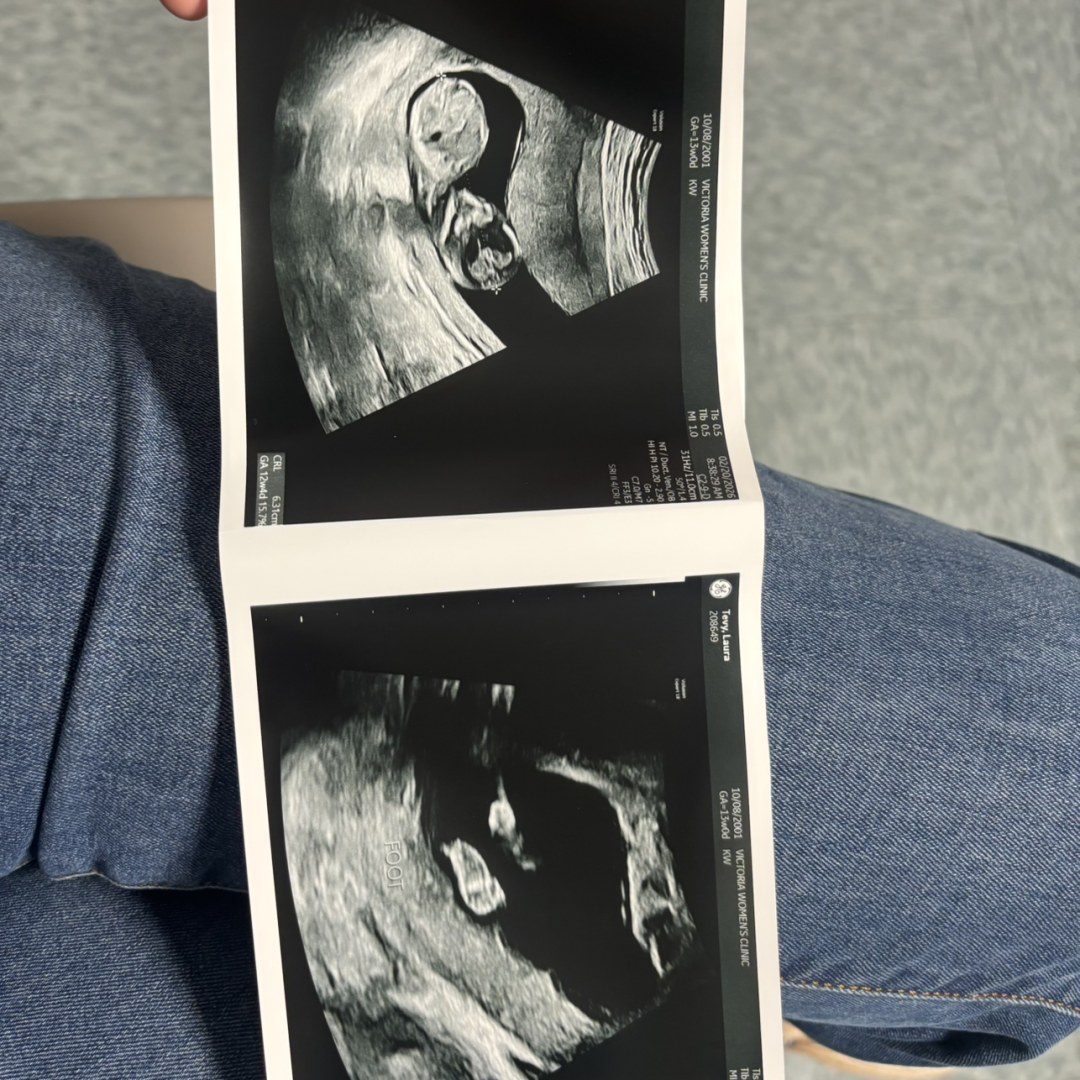 Photo shared by Alysa for their Babylist baby registry.