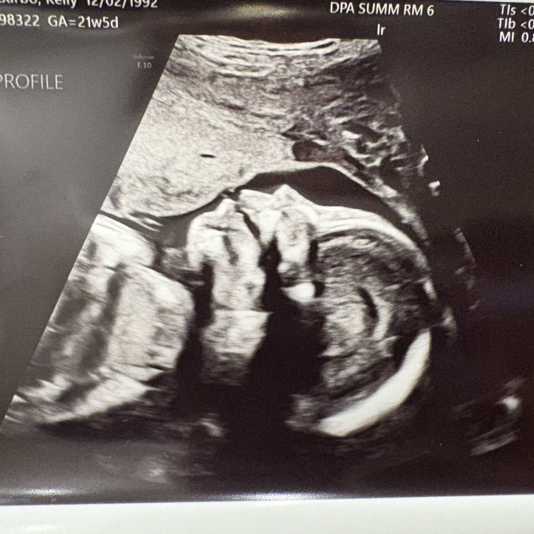 Photo shared by Kelley for their Babylist baby registry.