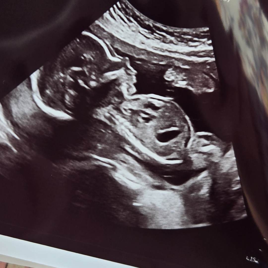 Photo shared by Brook for their Babylist baby registry.