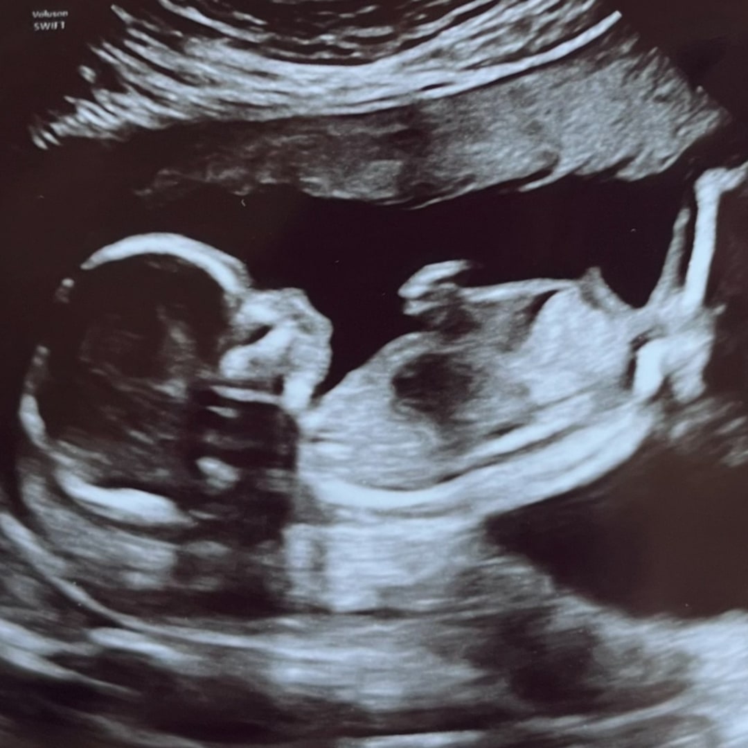 Photo shared by Madison for their Babylist baby registry.