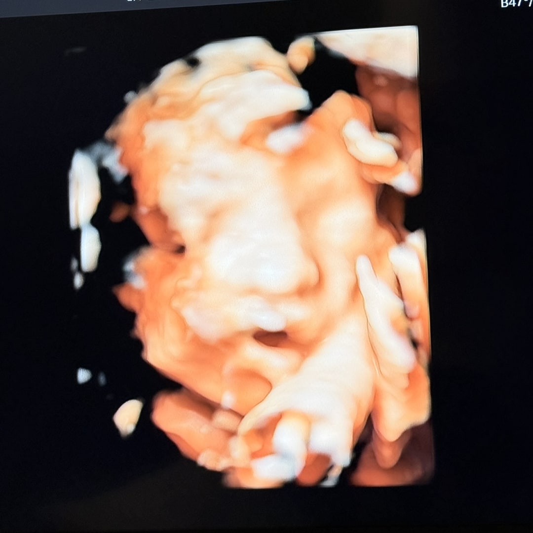 Photo shared by Lennis for their Babylist baby registry.