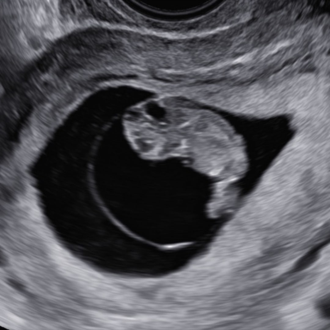 Photo shared by Stephanie for their Babylist baby registry.