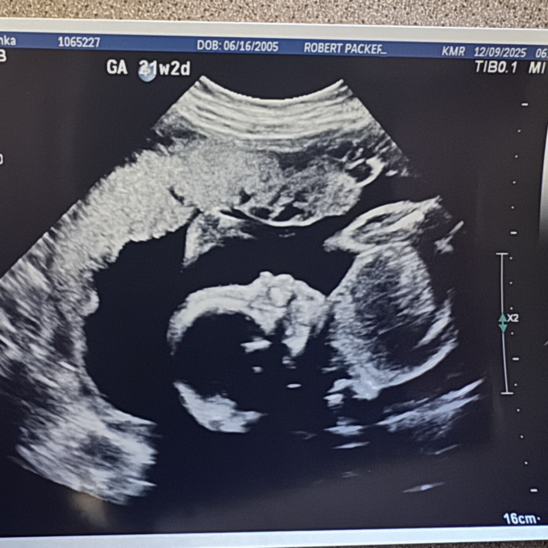 Photo shared by Bianka for their Babylist baby registry.