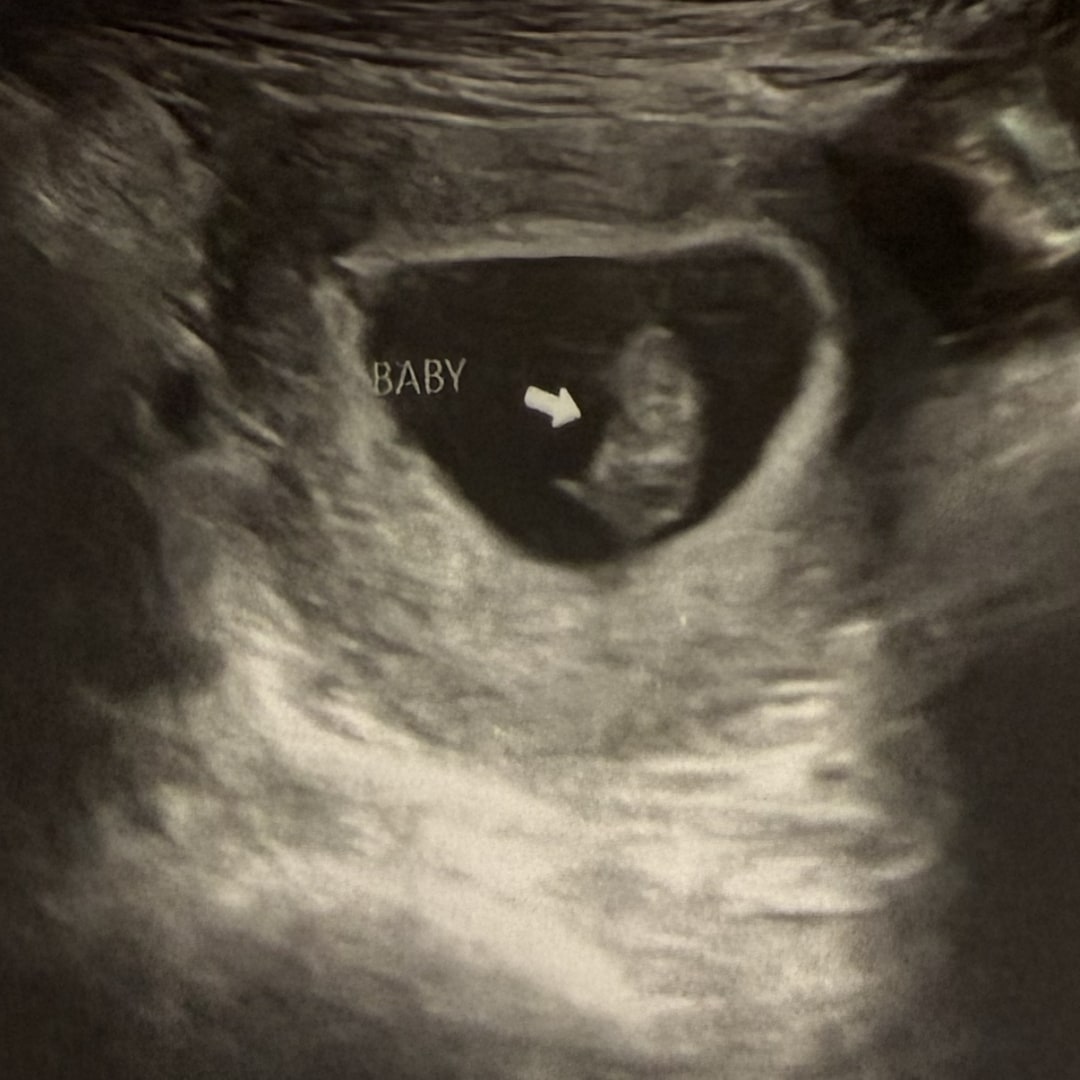 Photo shared by Ashton for their Babylist baby registry.