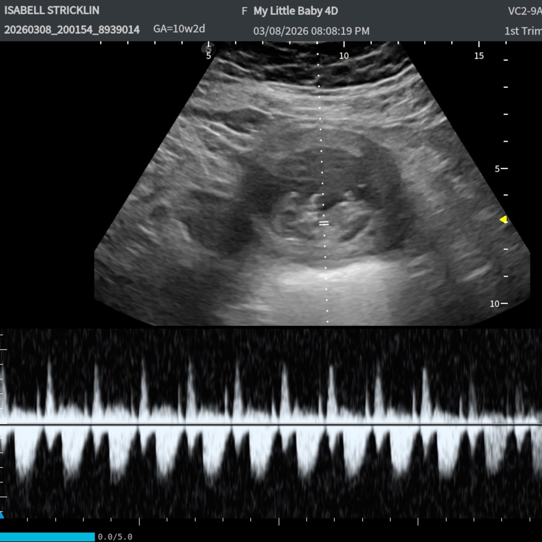 Photo shared by Isabell for their Babylist baby registry.