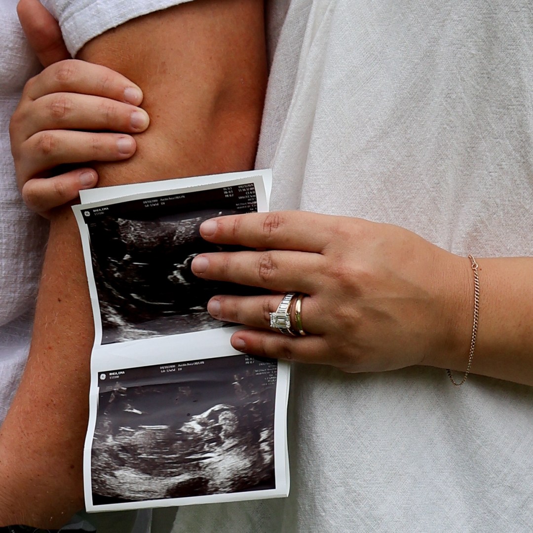 Photo shared by Ema for their Babylist baby registry.
