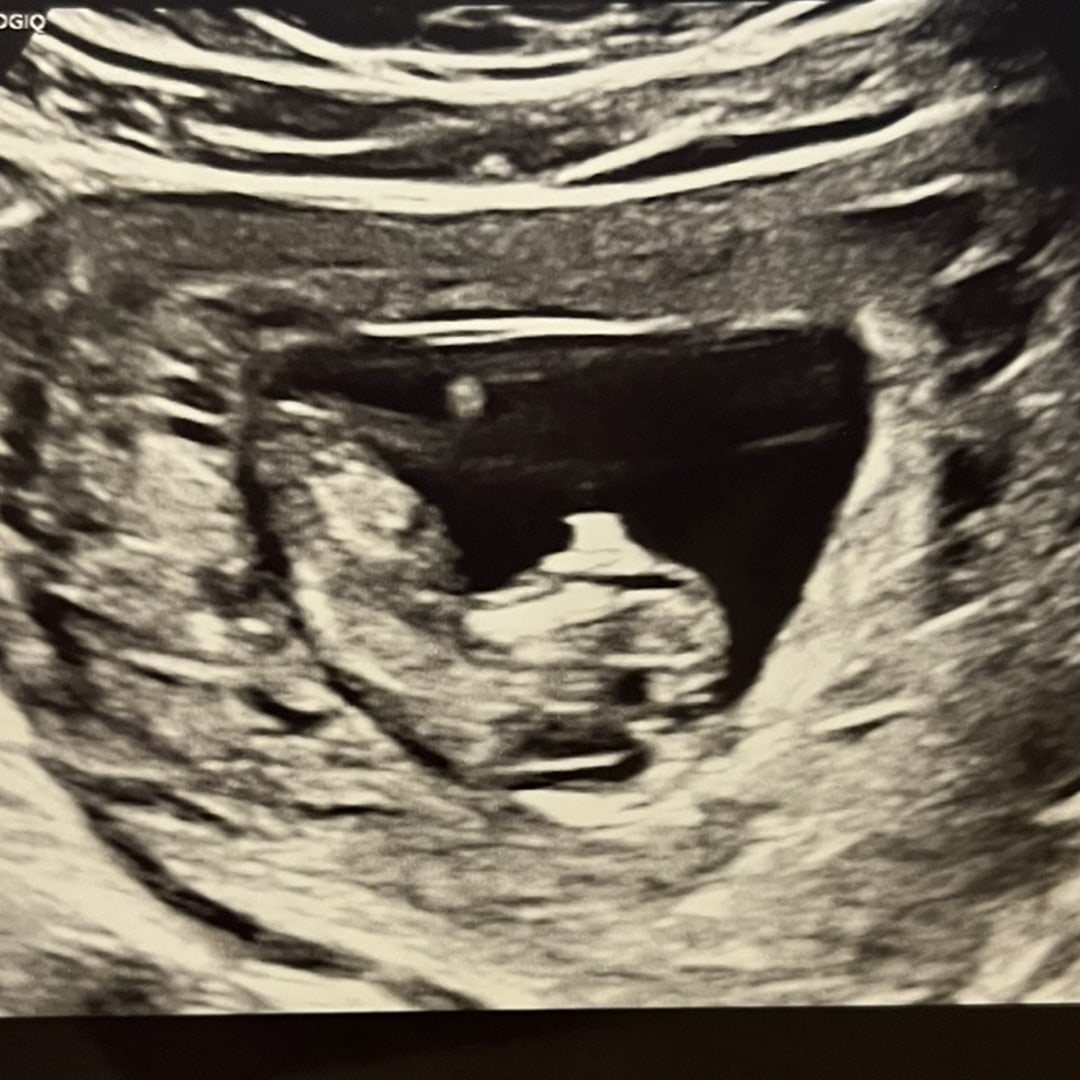 Photo shared by Samaya for their Babylist baby registry.