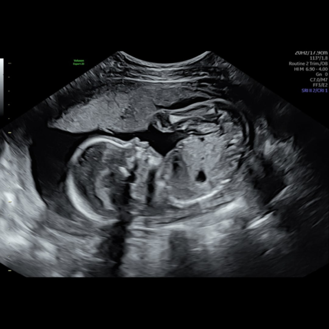 Photo shared by Angelina for their Babylist baby registry.