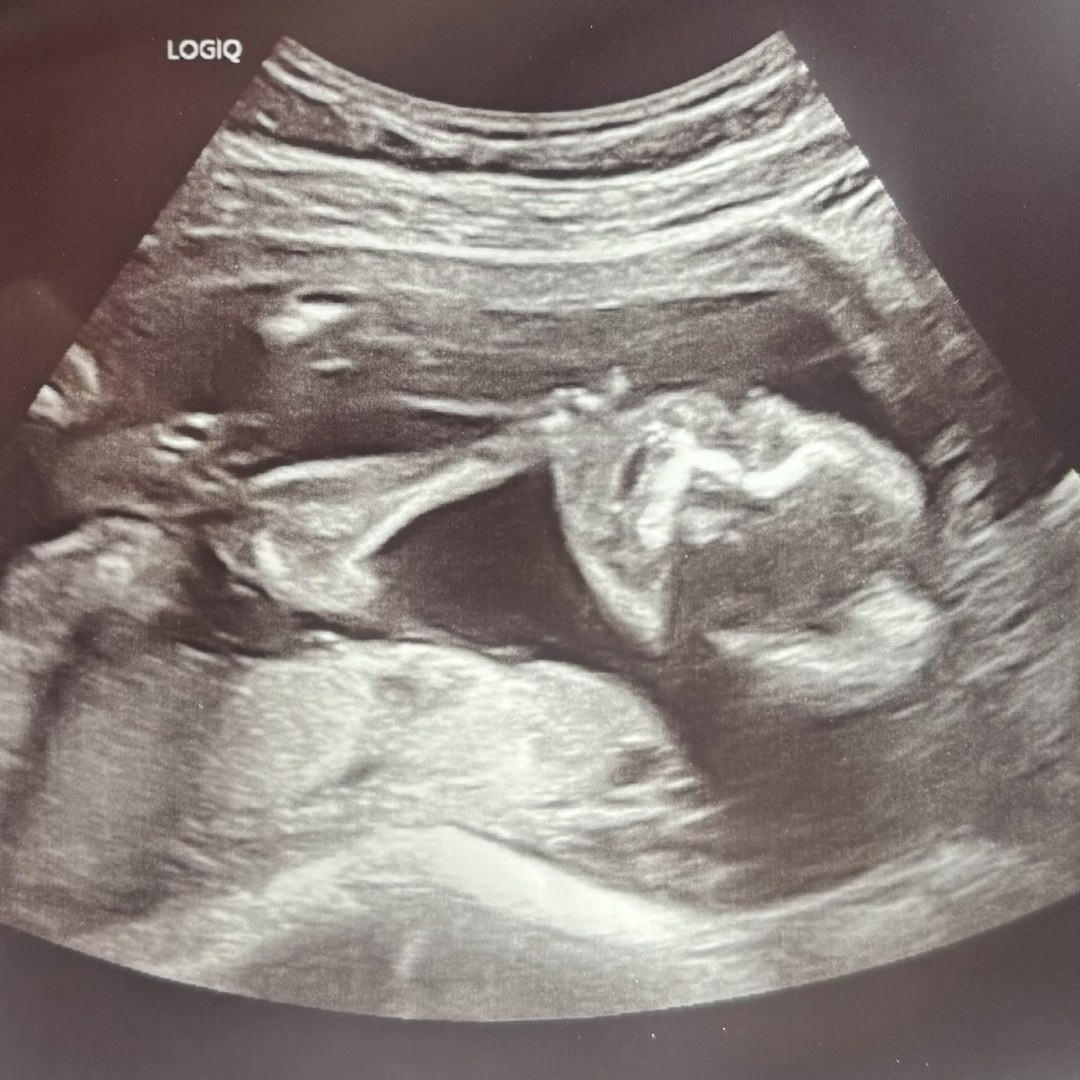 Photo shared by Jacqueline for their Babylist baby registry.