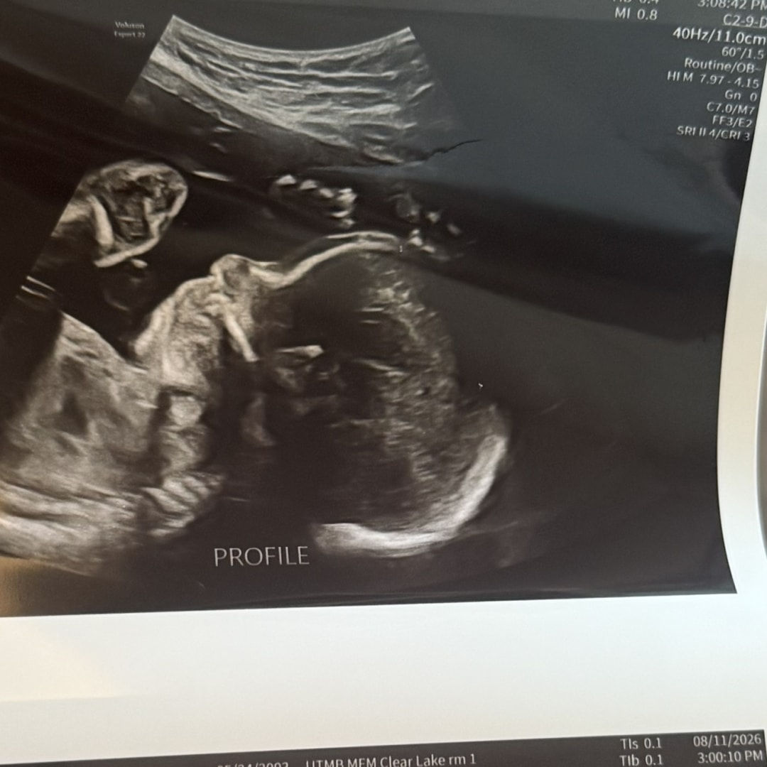 Photo shared by Keke for their Babylist baby registry.