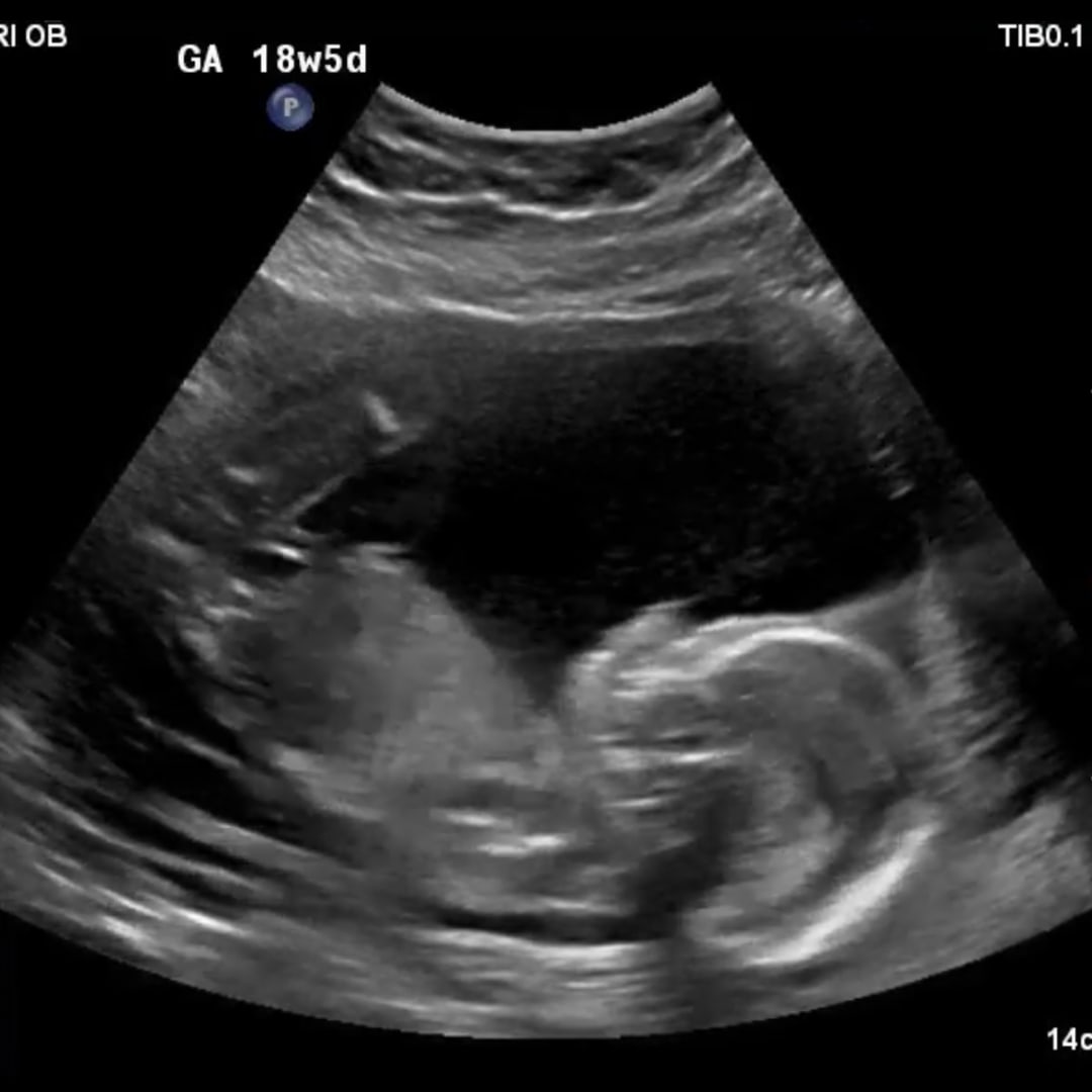 Photo shared by Chelsea for their Babylist baby registry.