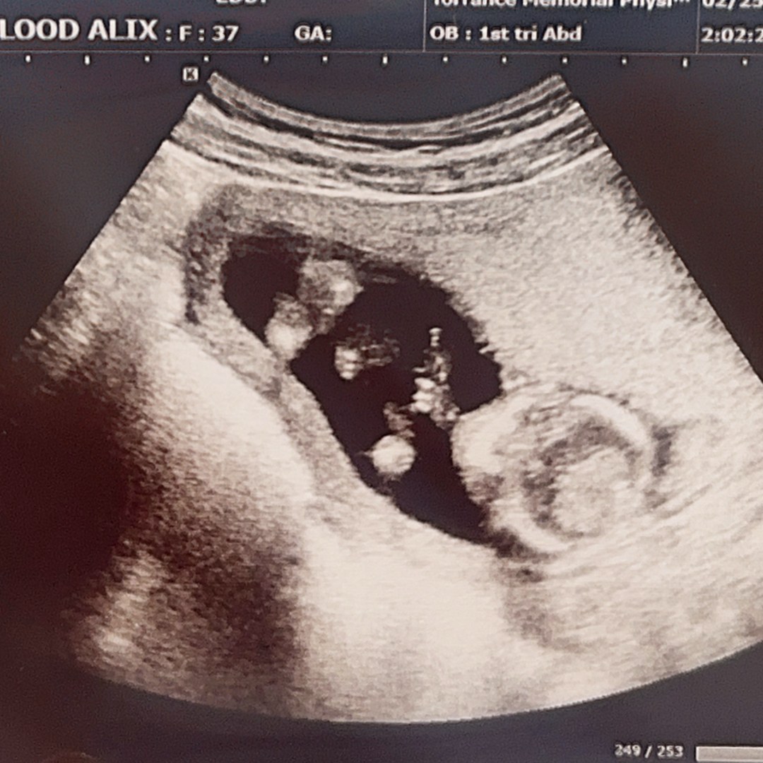 Photo shared by Alix for their Babylist baby registry.