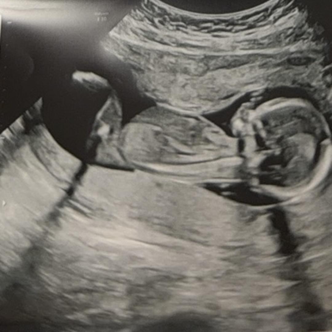 Photo shared by Dora for their Babylist baby registry.
