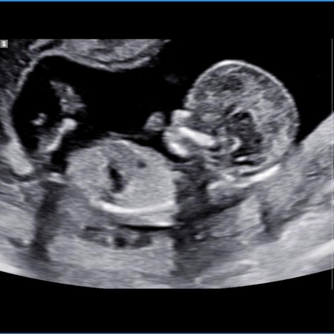 Photo shared by Caylen for their Babylist baby registry.
