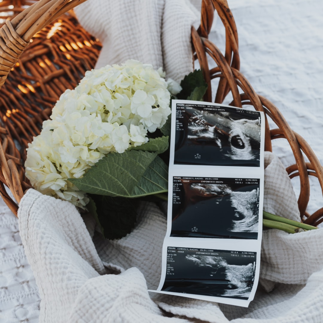 Photo shared by Rachel for their Babylist baby registry.