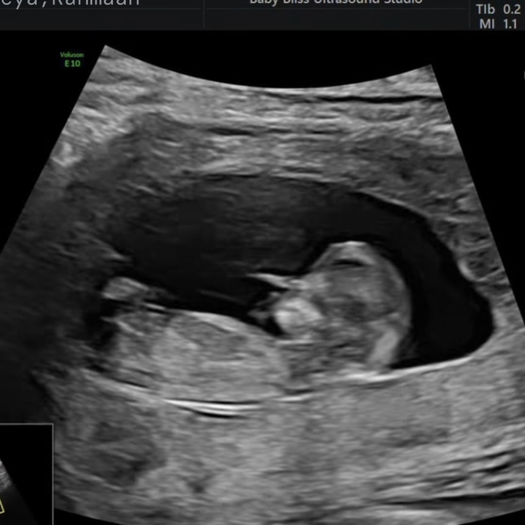 Photo shared by Nabreeya for their Babylist baby registry.
