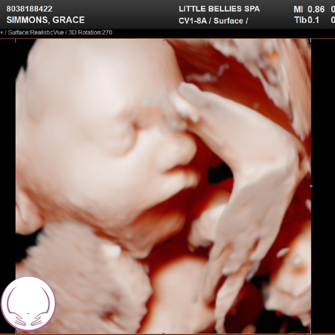 Photo shared by Grace for their Babylist baby registry.