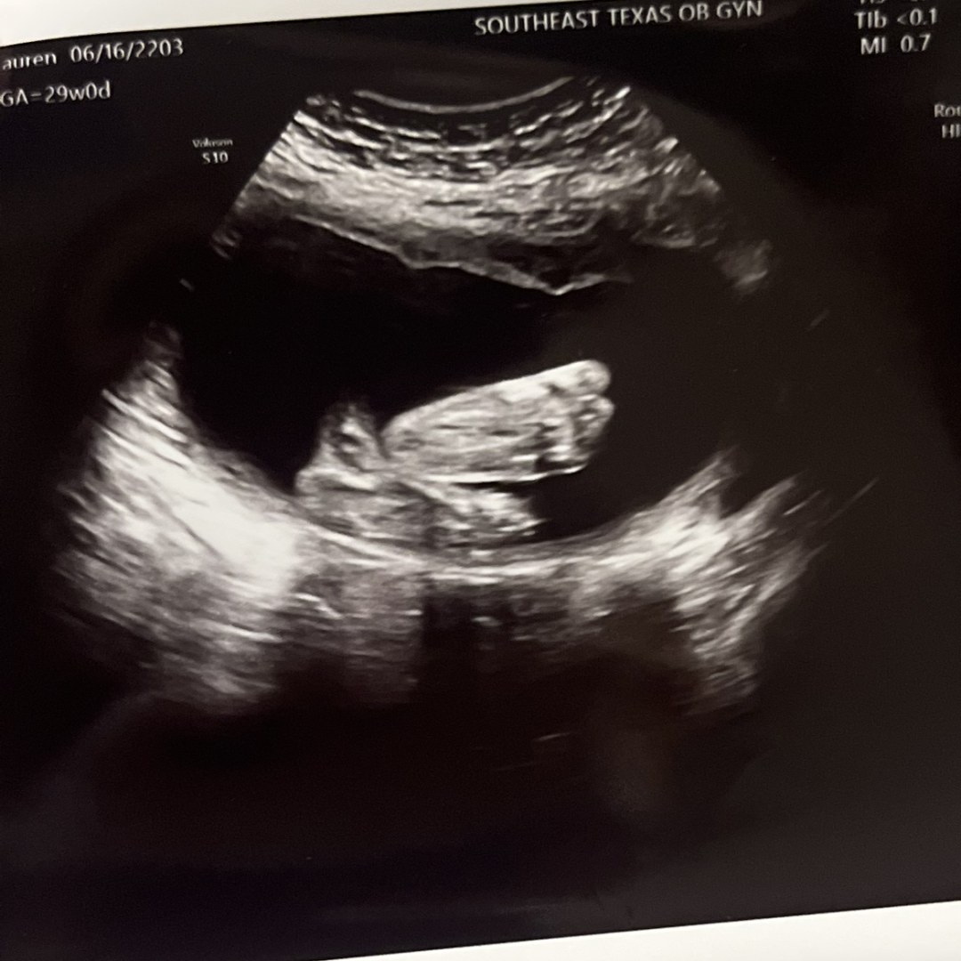 Photo shared by Lauren for their Babylist baby registry.
