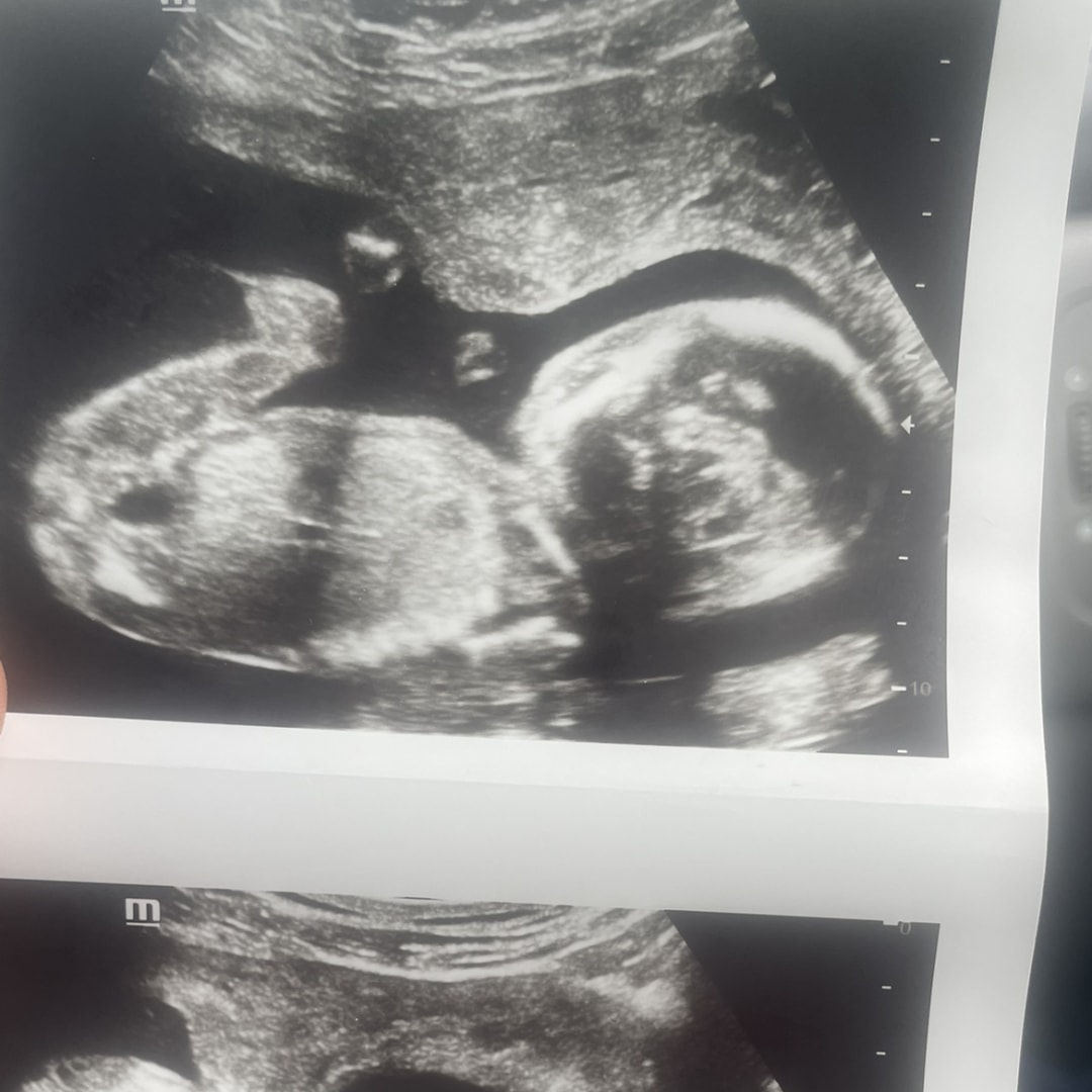 Photo shared by Ashli for their Babylist baby registry.