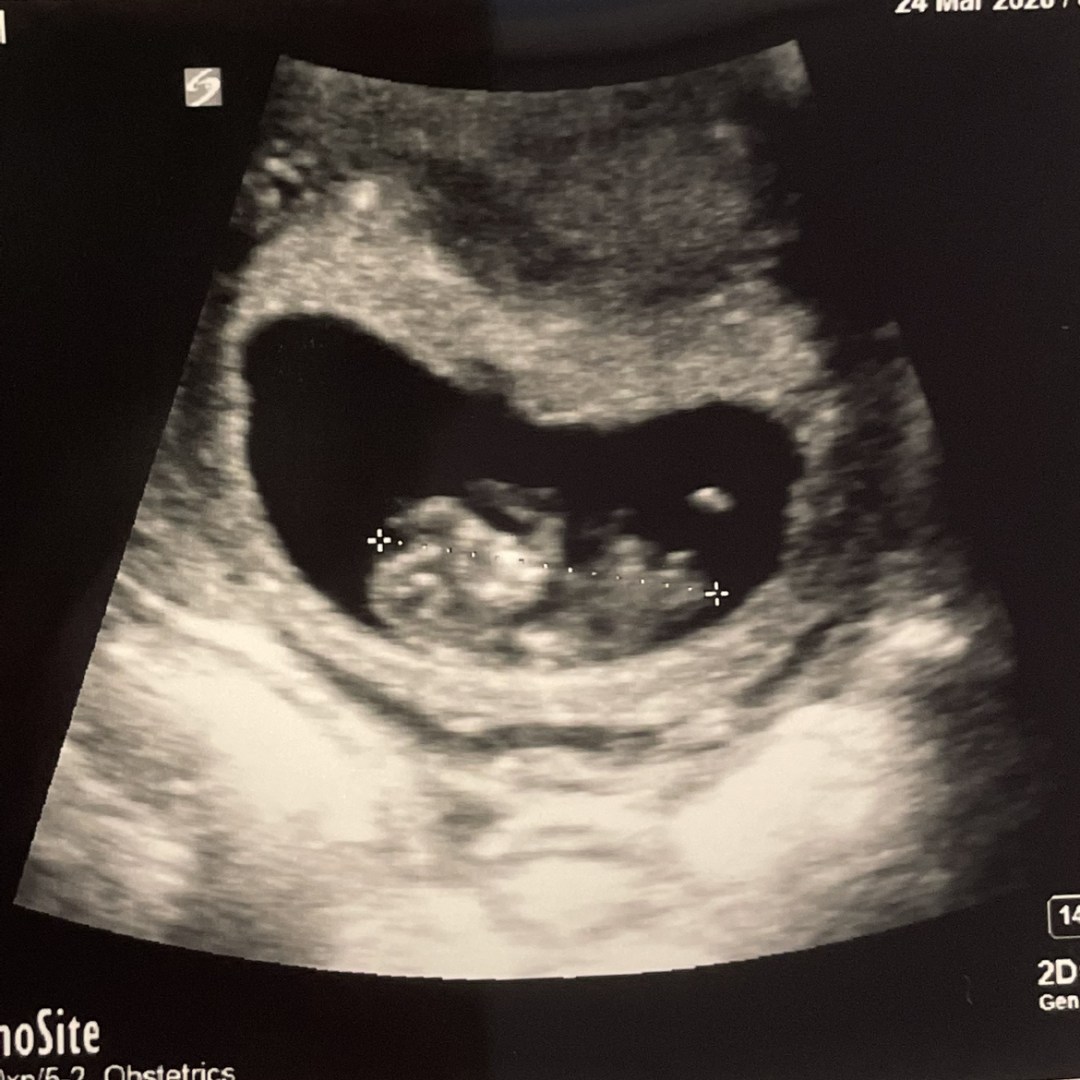 Photo shared by Alexi for their Babylist baby registry.